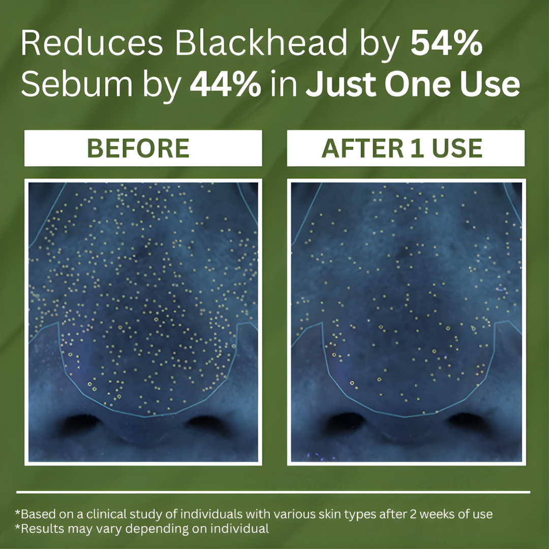 Daily Reminder™ - Holy Basil Bubble Deep Mask